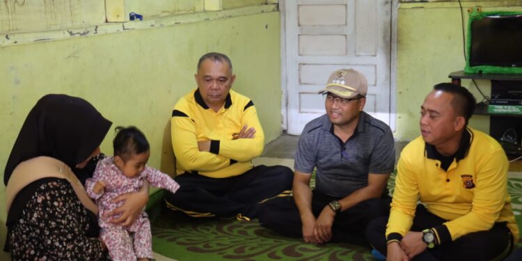 Empati Polres Aceh Tengah untuk Ranayya, Bocah Penderita Atresia Bilier